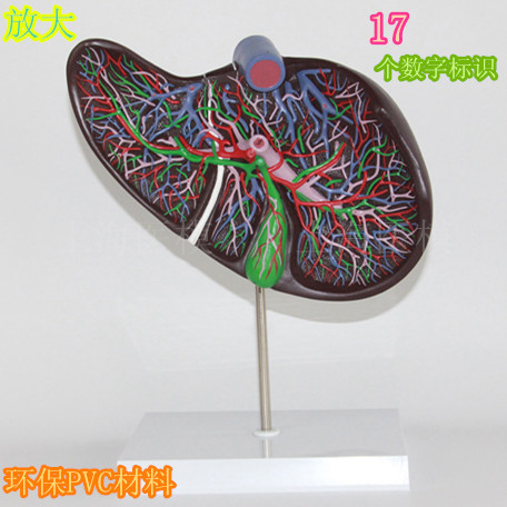 医信/MDCD 人体肝胆模型 肝脏模型 肝血管 肝胆放大模型 胆囊模型